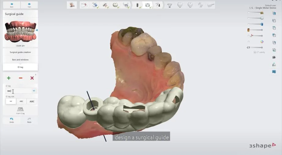 3Shape Implant Studio — planejamento virtual do implante em ambiente CAD